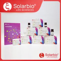谷草转氨酶/天门冬氨酸氨基转移酶(GOT/AST)活性检测试剂盒(卡门氏法)