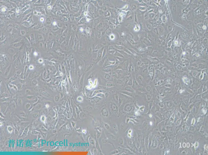 普诺赛LX-2（人肝星形细胞)：经STR鉴定的永生化HSC模型，研究起点更可靠