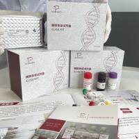猪(Porcine)黑色素瘤相关抗原(MAGE)ELISA检测试剂盒