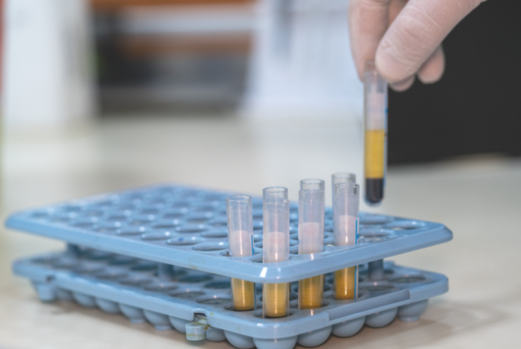 小样本量做CDKN1B ELISA，质控孔如何设置