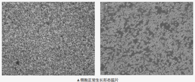 小鼠肝癌细胞 H22：从腹水瘤到贴壁培养，这段“身世”要搞清