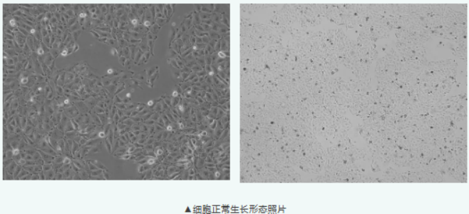 做肾毒性、药物转运常用猪肾细胞 LLC-PK1，这几点要注意