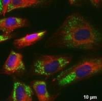 COL1A1 antibody [HL3040]