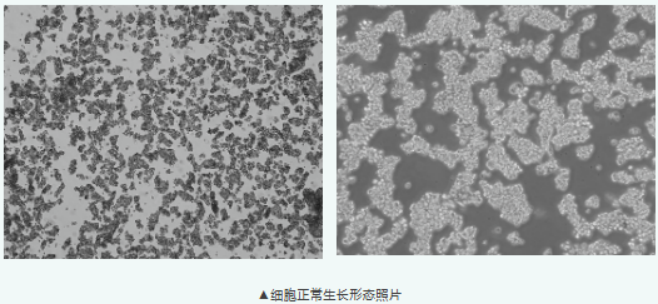 结直肠癌研究绕不开的 NCI-H716：一个会“抱团”的内分泌细胞株