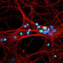 NeuroD1 antibody [HL3356]
