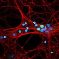 NeuroD1 antibody [HL3356]