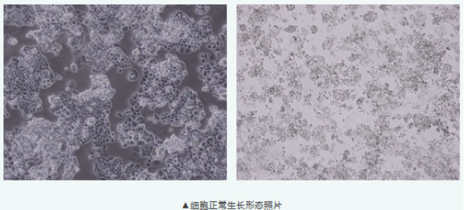 卵巢肿瘤细胞 COV434：贴壁慢、易脱落，培养别踩这几个坑
