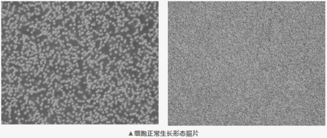 急性髓系白血病研究的老牌悬浮株 KG-1，培养要点一次说清