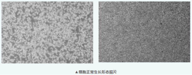 多发性骨髓瘤常用株 MM.1S，半贴壁“娇气”在哪儿？