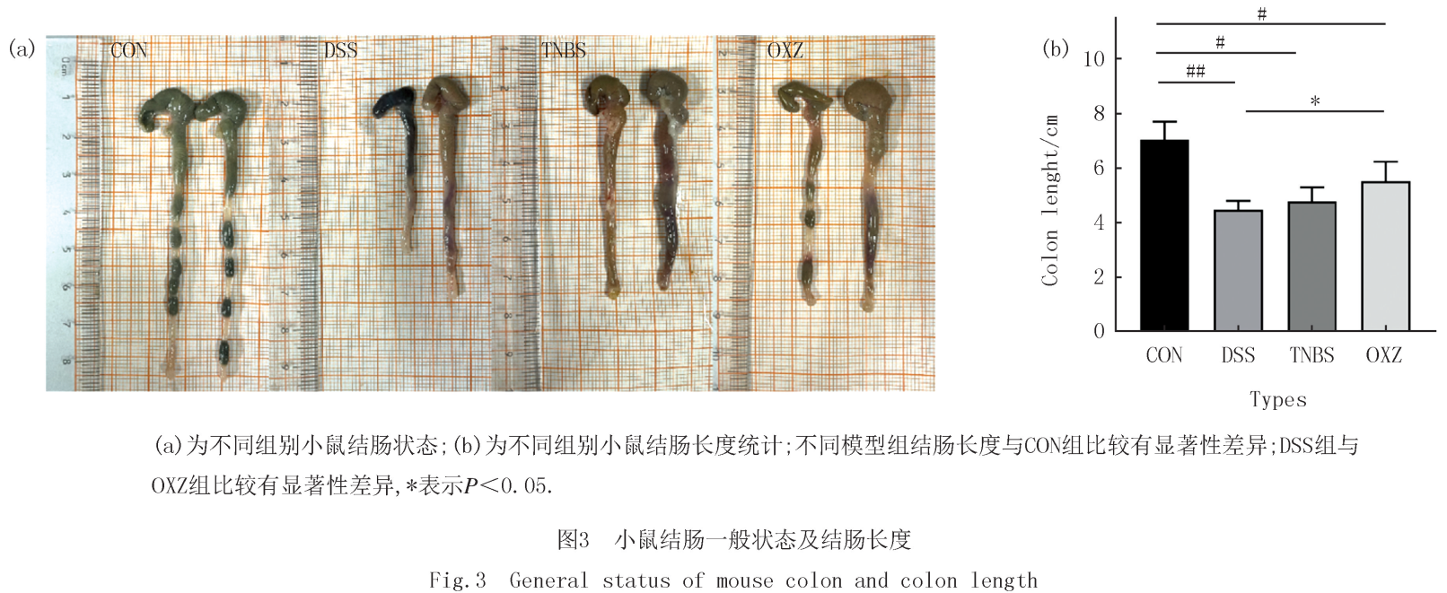 TNBS诱导急性溃疡性结肠炎（UC）小鼠模型构建