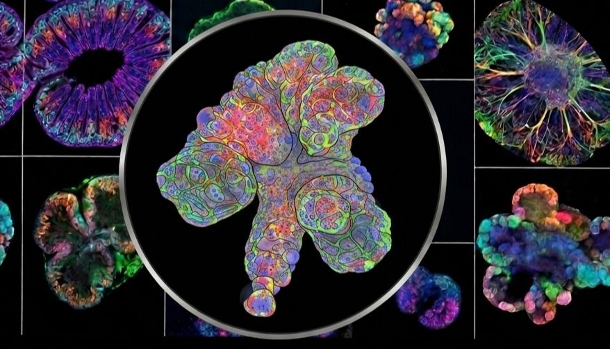 重磅预告！诺禾致源类器官服务即将正式上线：看Cell Stem Cell如何用配对类器官破译乳腺癌转移密码