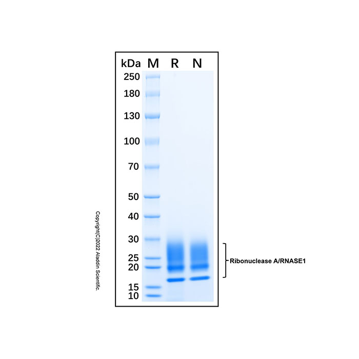 Recombinant Human Ribonuclease A/RNASE1 Protein,无动物源, 无载体, His标签, ≥95%(SDS-PAGE), expressed in HEK293; 见COA,阿拉丁