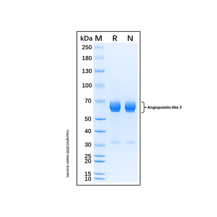 Recombinant Human Angiopoietin-like 3 Protein，无动物源, 无载体, His标签, ≥90%(SDS-PAGE), expressed in HEK293; 见COA，阿拉丁