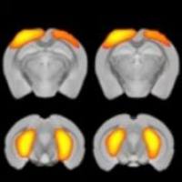 核磁共振成像（MRI）