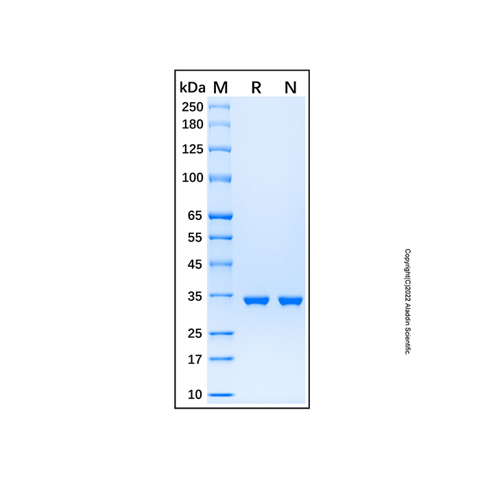 Recombinant Human CDK2 Protein,无载体,生物活性,ActiBioPure™,His标签,≥95%(SDS-PAGE),见COA,阿拉丁