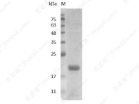 IL-1β/IL1B1/IL1B, Swine, Recombinant