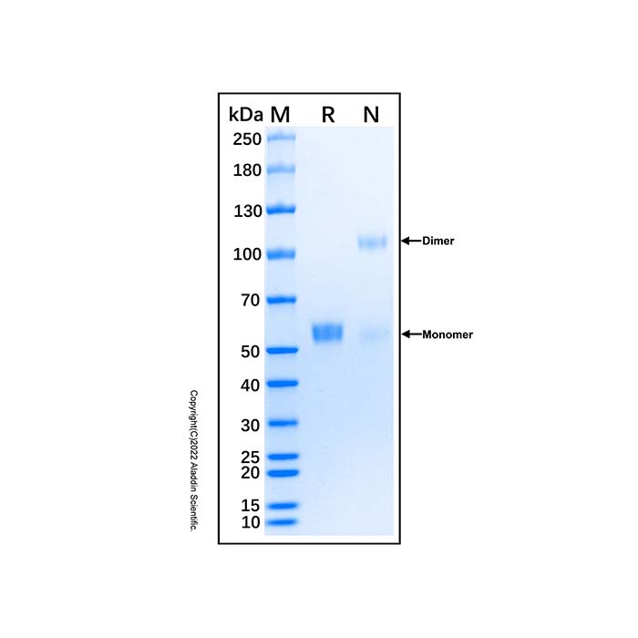 Recombinant Human Osteoprotegerin/TNFRSF11B Protein,无动物源, 无载体, His标签, ≥95%(SDS-PAGE), expressed in HEK293; 见COA,阿拉丁产品图