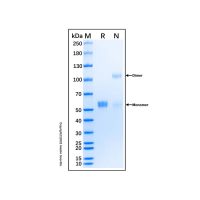 Recombinant Human Osteoprotegerin/TNFRSF11B Protein，无动物源, 无载体, His标签, ≥95%(SDS-PAGE), expressed in HEK293; 见COA，阿拉丁