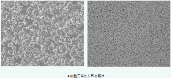 结直肠癌研究绕不开的 HT-29，成簇生长该怎么处理