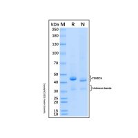 Recombinant Human TXNDC4 Protein,无动物源, 无载体, His标签, ≥85%(SDS-PAGE), expressed in HEK293; 见COA ,阿拉丁