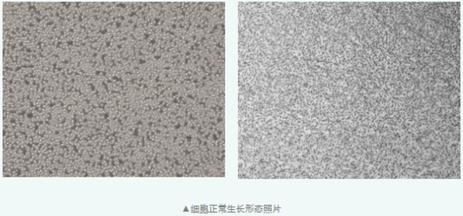 单核/巨噬细胞分化的老牌模型 U-937，悬浮培养要注意这几点