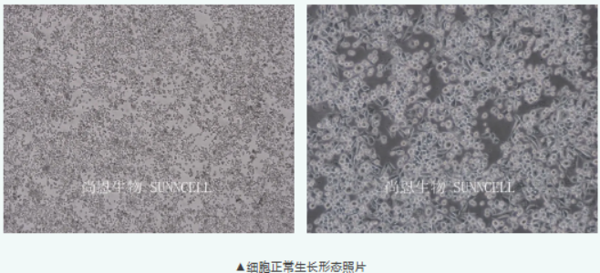 胃印戒细胞癌研究的 SNU601，贴壁有“两副面孔”