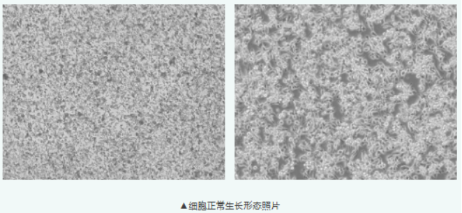 小鼠胃癌细胞 MFC：贴壁弱、长得快，培养别踩坑