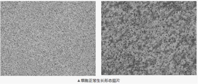 胰腺癌研究常用株 AsPC-1，复苏慢这点要心里有数