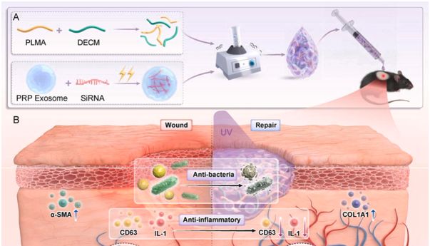 Bioactive Materials｜浙江大学团队：电穿孔“武装”PRP外泌体装载siRNA-PHD2，联合DECM/PLMA水凝胶，抗菌-促血管-促重塑三效