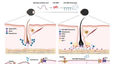 JNB 高分解读｜脐带 MSC 外泌体：多靶点协同攻克雄激素性脱发，从细胞、动物走到人体临床