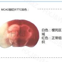 大小鼠MCAO模型/脑梗模型