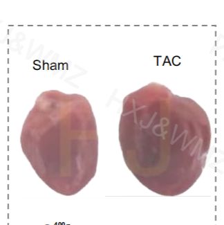 TAC心肌肥厚/心衰模型