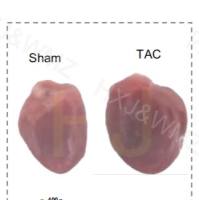 TAC心肌肥厚/心衰模型