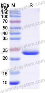 AntibodySystem蛋白抗体 |Recombinant Human KRT18 Protein, N-His重组人角蛋白18 · 细胞骨架与肿瘤标志物研究核心蛋白