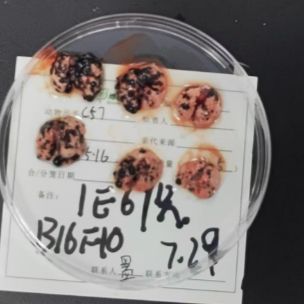 黑色素瘤模型