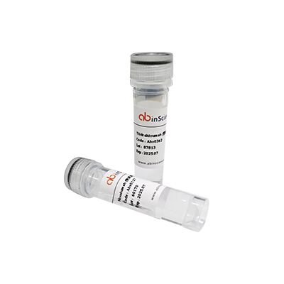 Anti-CXCL2/GRO-beta/MIP2-alpha Polyclonal Antibody产品图