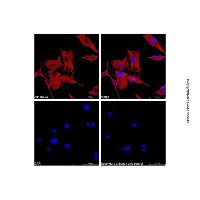 Goat Anti-Mouse IgG H&L (AF555)，ExactAb™, 已验证, Ex:553nm, Em:568nm, 1.0 mg/mL，阿拉丁