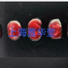 TTC染色实验