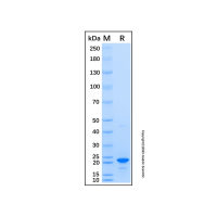 Recombinant Human HLA-DOA Protein,无载体, His标签, ≥90%(SDS-PAGE), expressed in E. coli; 见COA,阿拉丁
