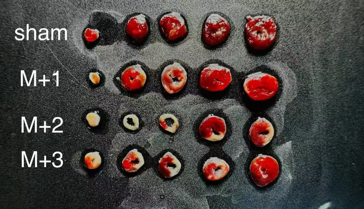 小鼠心肌梗死模型