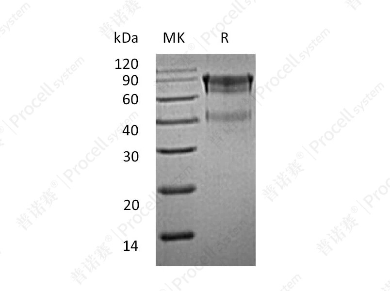 IL-15RA/CD215 (C-Fc), Mouse, Recombinant