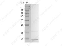 IGF-I/Somatamedin C/IGF-IA, Human, Recombinant