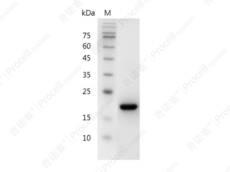 SCF/c-Kit/KIT ligand, Human, Recombinant产品图