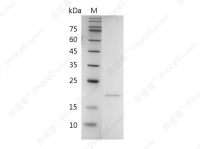 RANKL/TNFSF11/TRANCE/CD254, Human, Recombinant