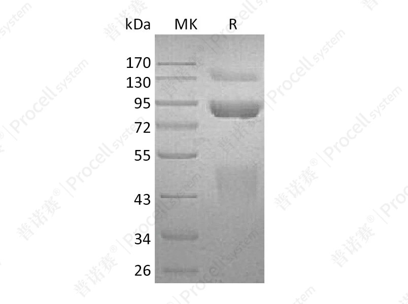 HGF R/c-Met/HGFR, Human, Recombinant产品图