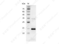 IL-21/Za11, Mouse, Recombinant