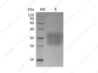 MCP-1/CCL2 (C-6His), Mouse, Recombinant