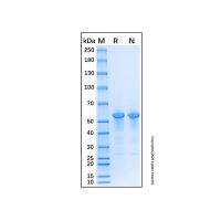Recombinant Human Fibronectin Fragment Protein,86088-83-7,无动物源,无载体,生物活性,ActiBioPure™,高性能,无菌,His标签,PBS Only,≥98%(SDS-PAGE),阿拉丁