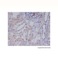Acetyl Coenzyme A Carboxylase Antibody,重组, ExactAb™, 已验证, 见COA,阿拉丁