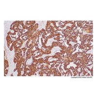 Recombinant Calcitonin Antibody,ExactAb™, Validated, Recombinant, 0.05 mg/mL,阿拉丁